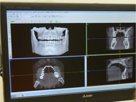 口腔外科の画像